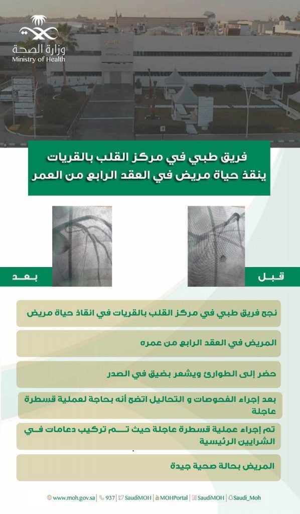 فريق طبي في مركز القلب بالقريات ينقذ حياة مريض في العقد الرابع من العمر