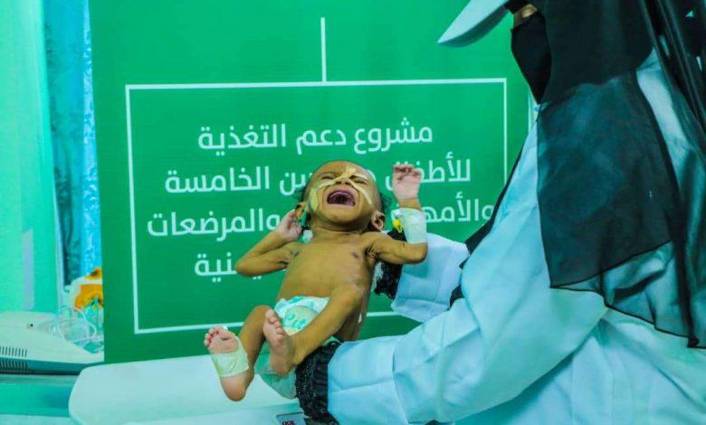 مشروع دعم التغذية للأطفال والأمهات يقدم خدماته لـ 12,084 مستفيدا في اليمن خلال أسبوع بدعم من مركز الملك سلمان للإغاثة