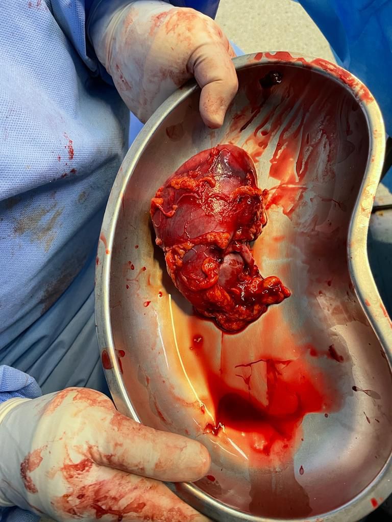 أكثر من 10 الآف خدمة طبية وإزالة قطعة زجاجية من داخل بطن مريضة